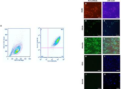 Male Macrophages and Fibroblasts from C57/BL6J Mice Are More Susceptible to Inflammatory Stimuli